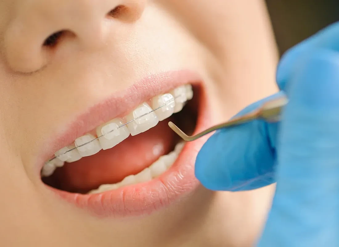 Patient in dental chair during a routine checkup