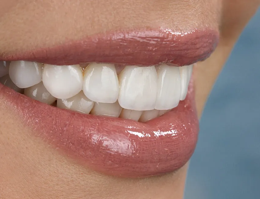 Cosmetic Dentistry in Torrance, CA