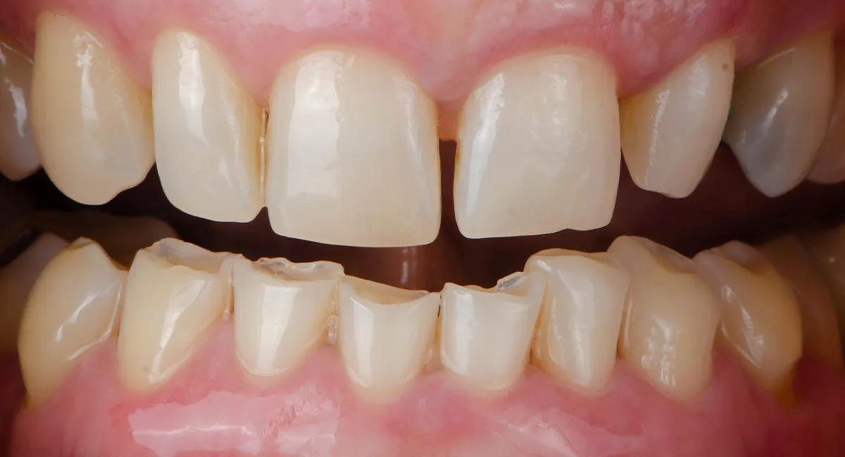 Before — smile case 8