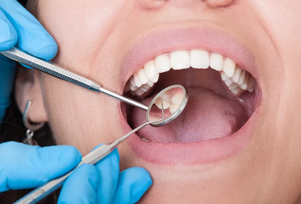 Warning Signs You Need to See a Dentist