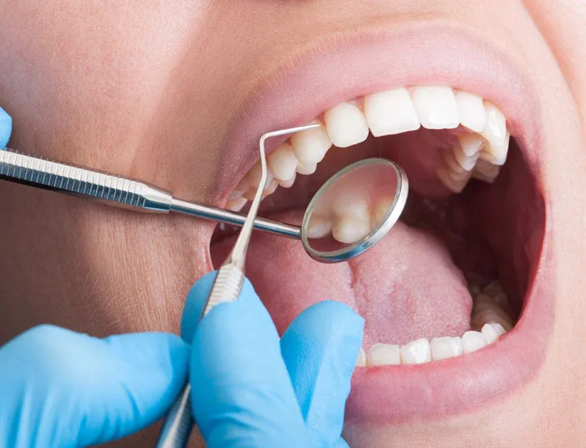 Preventative Dentistry at Torrance Dental Spa