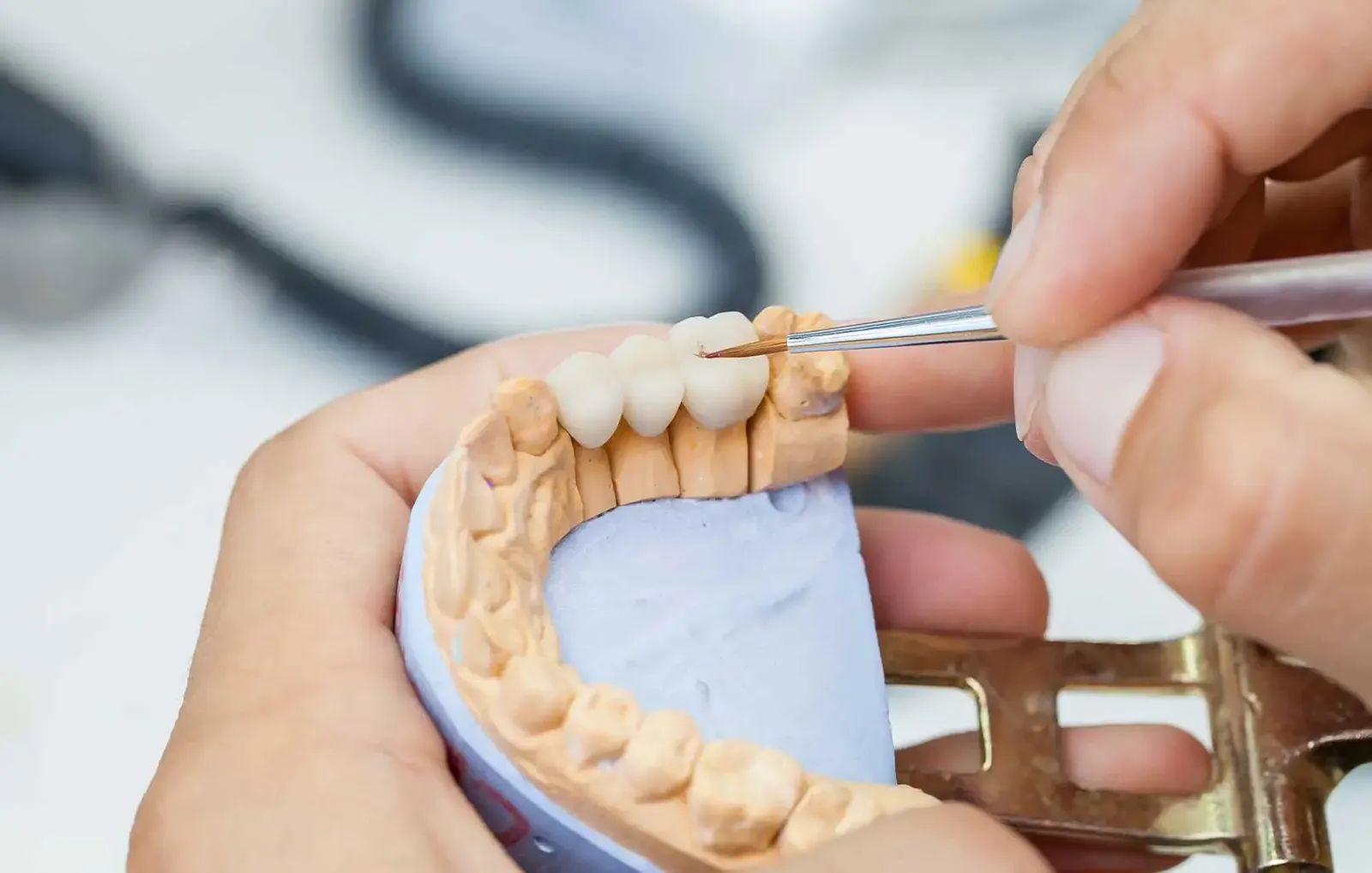 Tooth Crown: Purpose, Procedure, and Cost