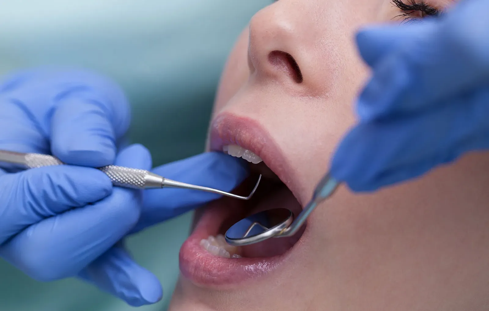 Why Does My Dentist Want to Replace a Filling That Doesn’t Bother Me?