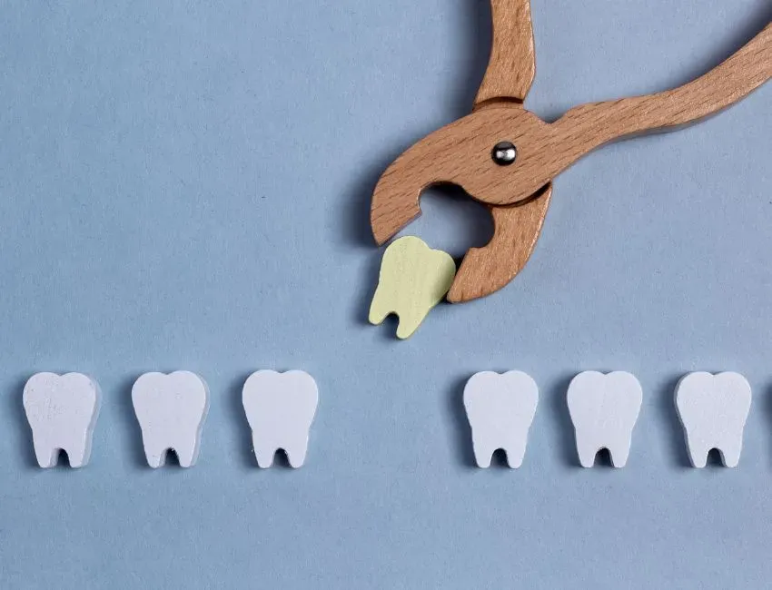 What’s the Safest Way to Recover After a Tooth Extraction?