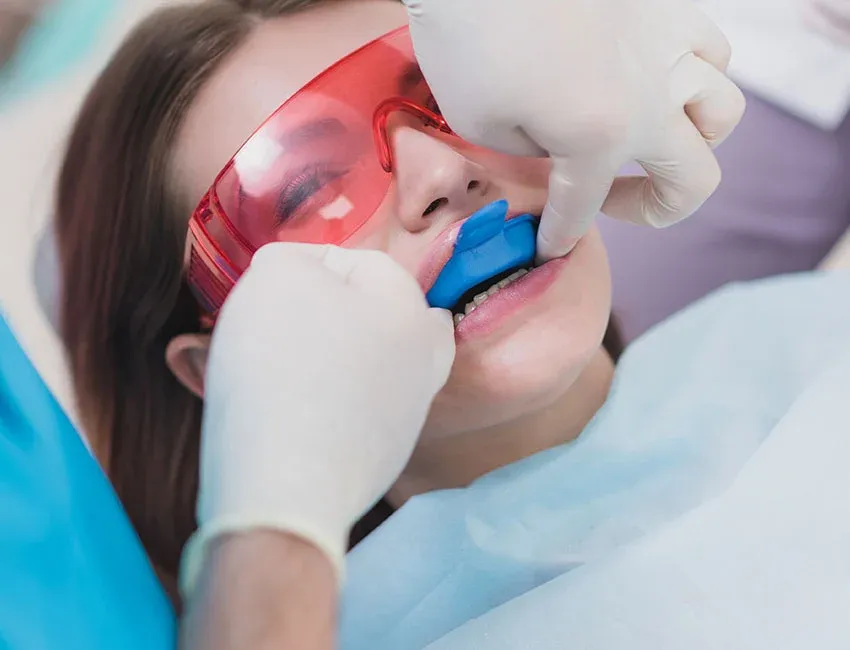 Fluoride Treatments at Torrance Dental Spa