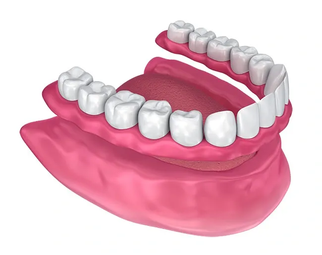 Signs you may need full and partial dentures — Torrance Dental Spa