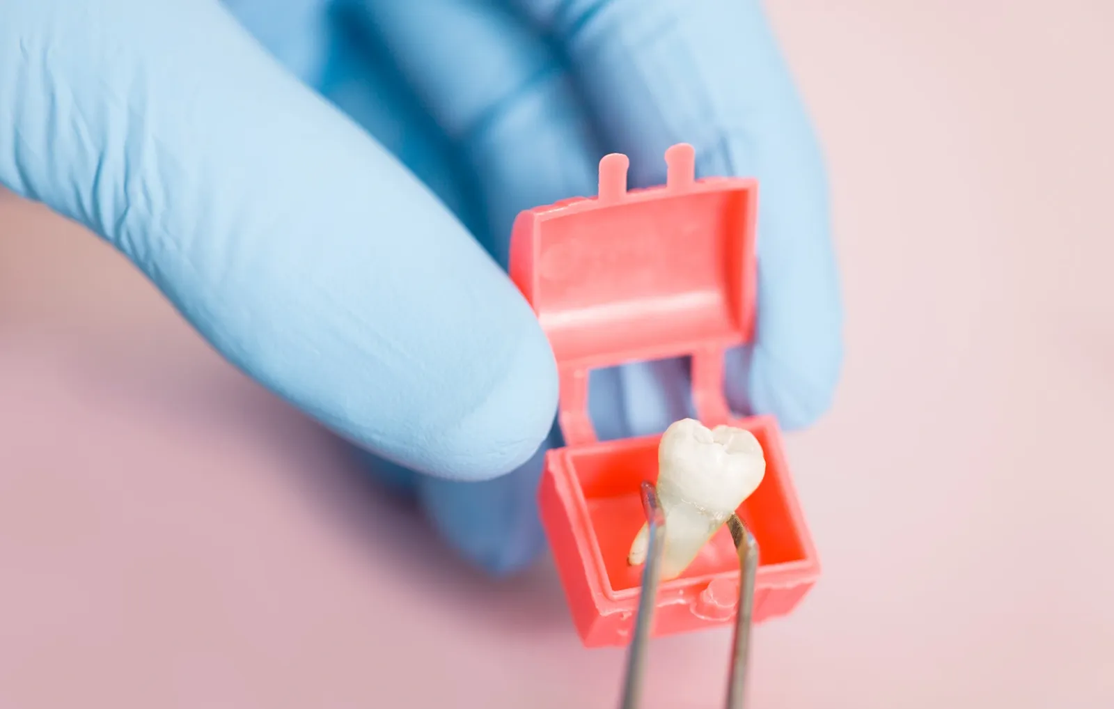 Wisdom Teeth Removal in Torrance, CA